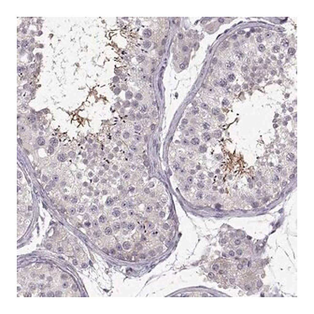 Merck Anti-SPATA32 antibody produced in rabbit
