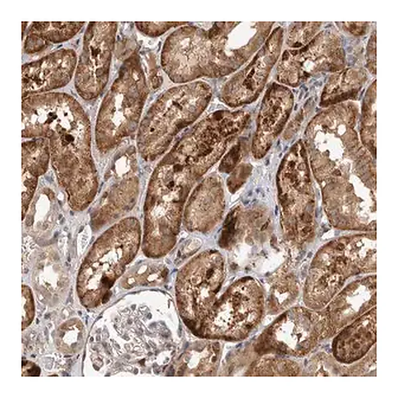 Merck Anti-INSRR antibody produced in rabbit