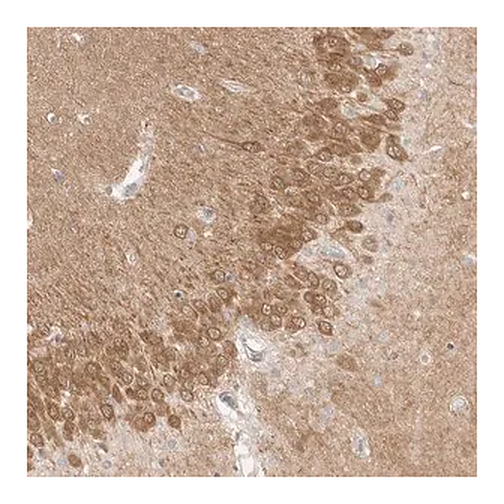 Merck Anti-MAP2K1 antibody produced in rabbit