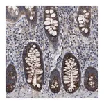 Merck Anti-TECPR1 antibody produced in rabbit