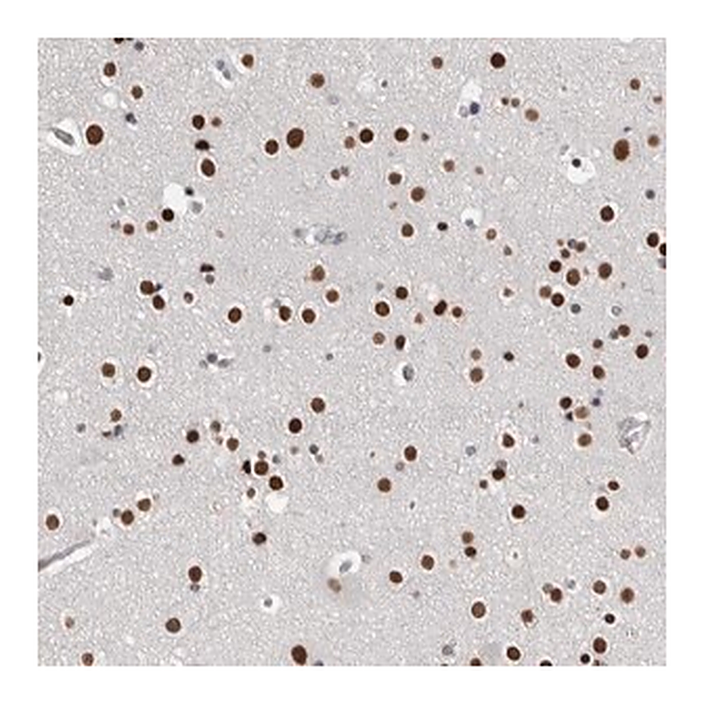 Merck Anti-ZBTB49 antibody produced in rabbit