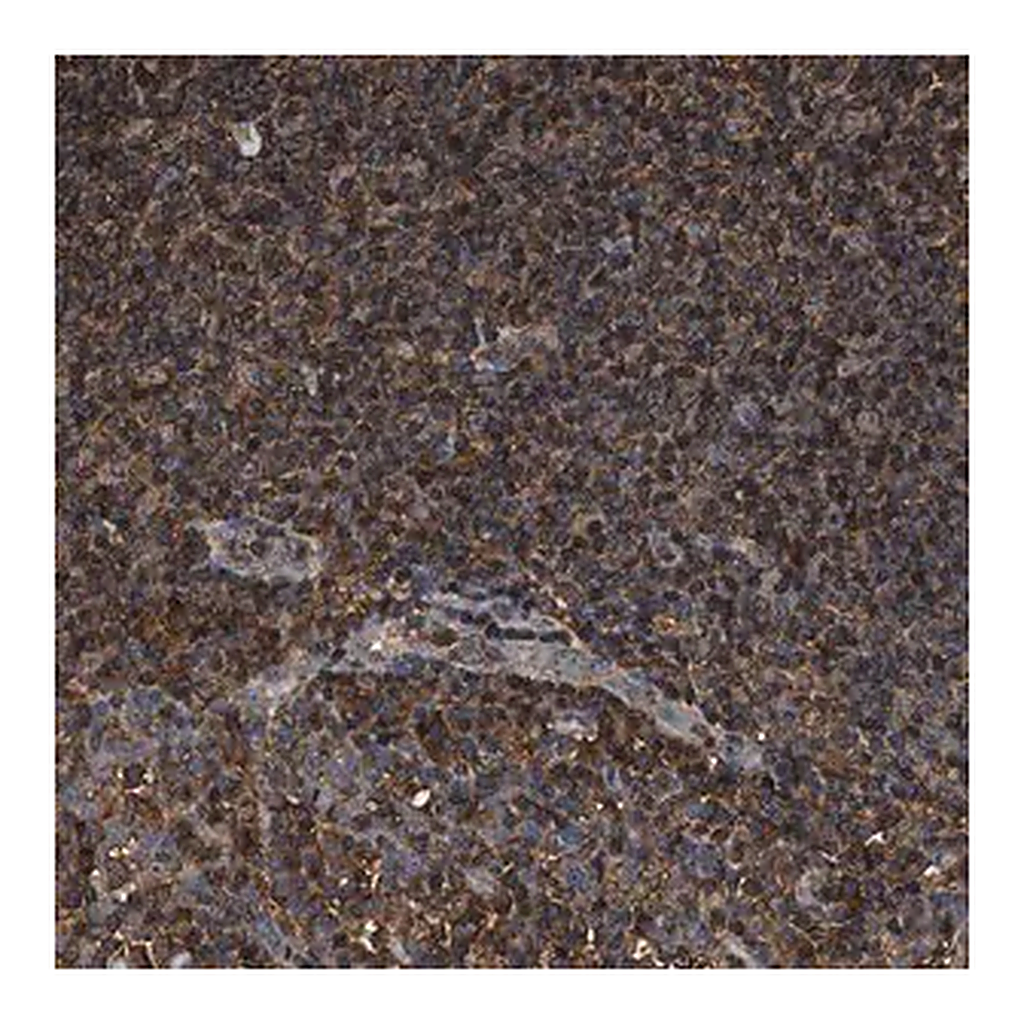 Merck Anti-KBTBD2 antibody produced in rabbit