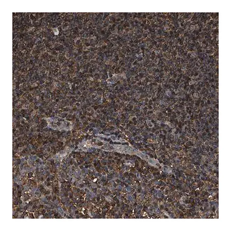 Merck Anti-KBTBD2 antibody produced in rabbit