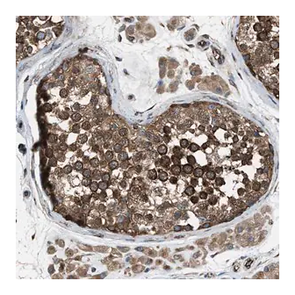Merck Anti-TRPC1 antibody produced in rabbit
