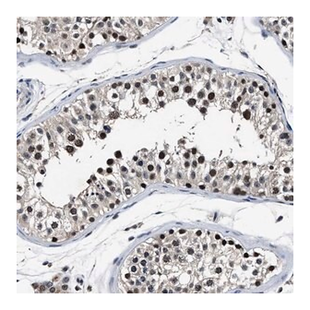 Merck Anti-USP16 antibody produced in rabbit