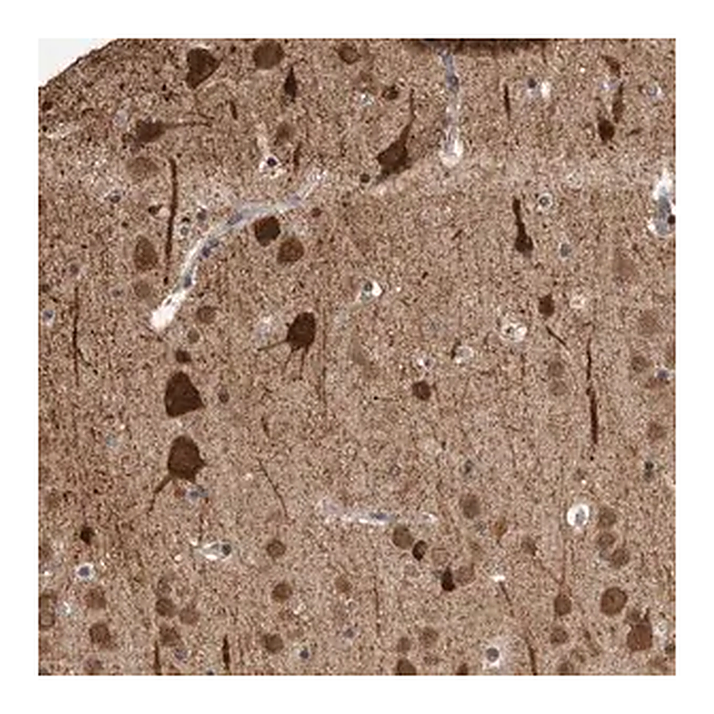 Merck Anti-OR2K2 antibody produced in rabbit