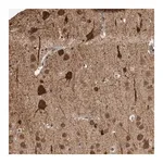 Merck Anti-OR2K2 antibody produced in rabbit