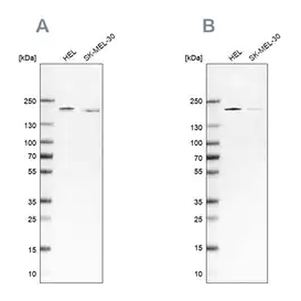 Merck Anti-SMARCC2 antibody produced in rabbit