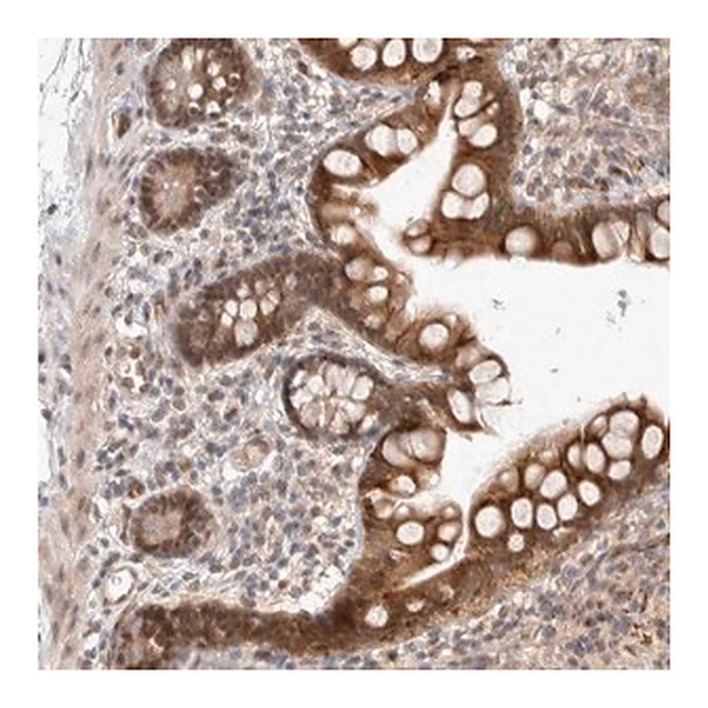 Merck Anti-ZNF704 antibody produced in rabbit