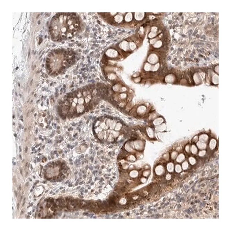 Merck Anti-ZNF704 antibody produced in rabbit