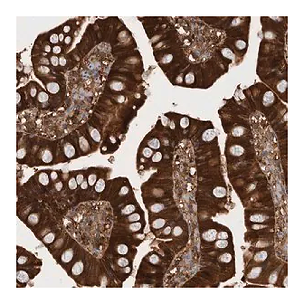 Merck Anti-RHPN1 antibody produced in rabbit