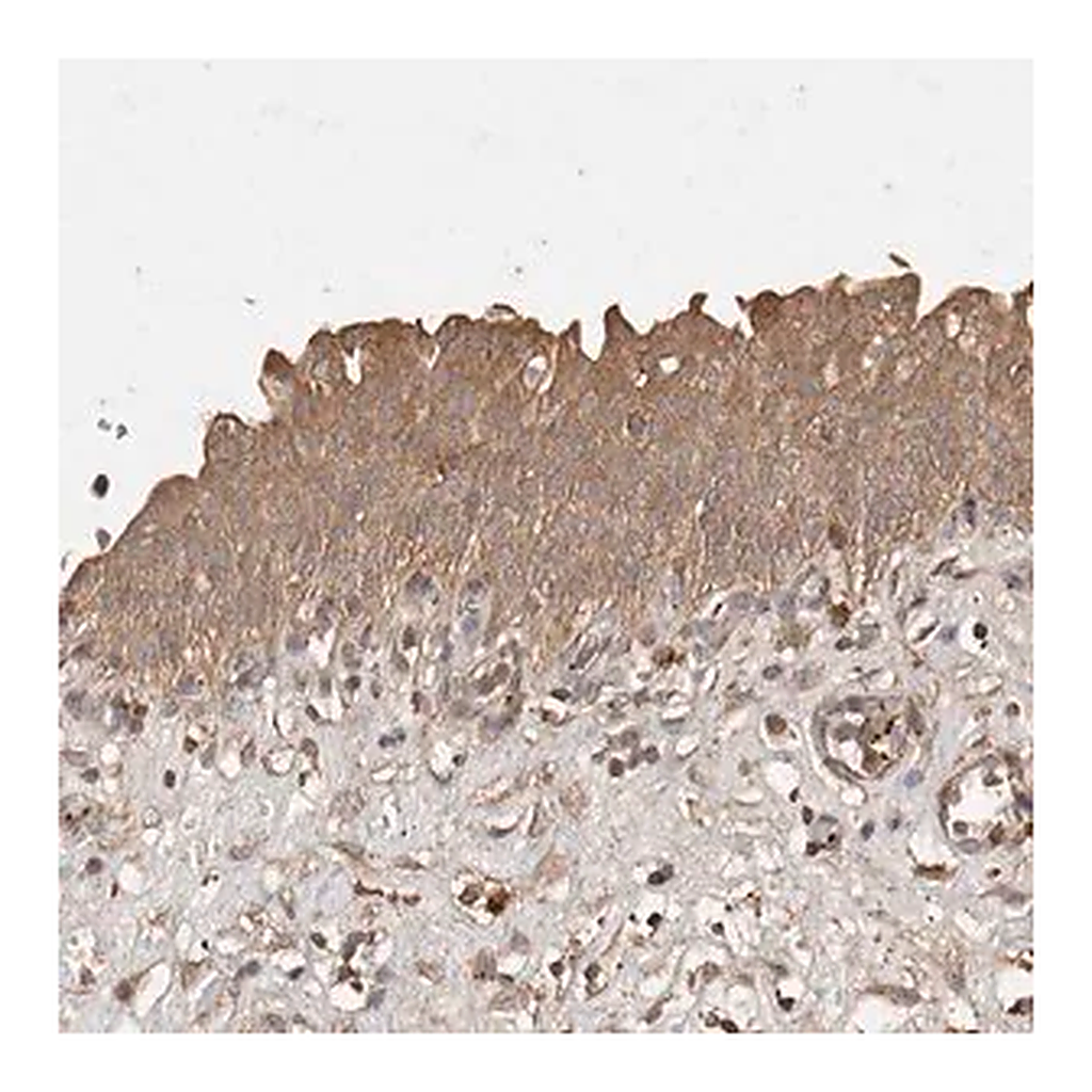 Merck Anti-SNX31 antibody produced in rabbit