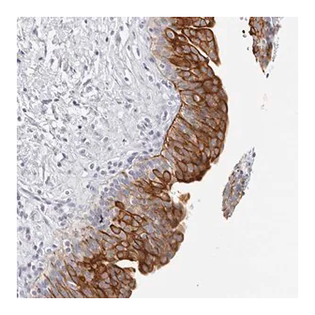 Merck Anti-RPH3AL antibody produced in rabbit