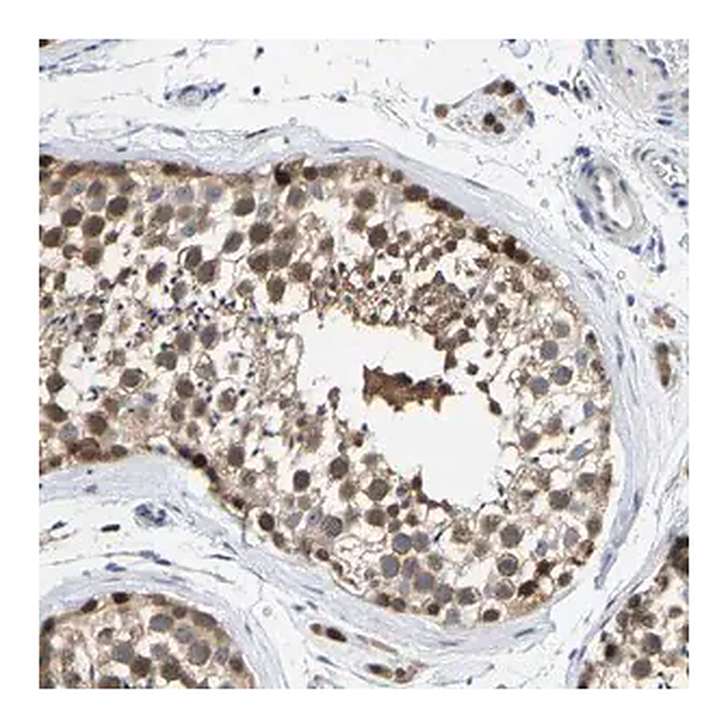 Merck Anti-KLHL1 antibody produced in rabbit