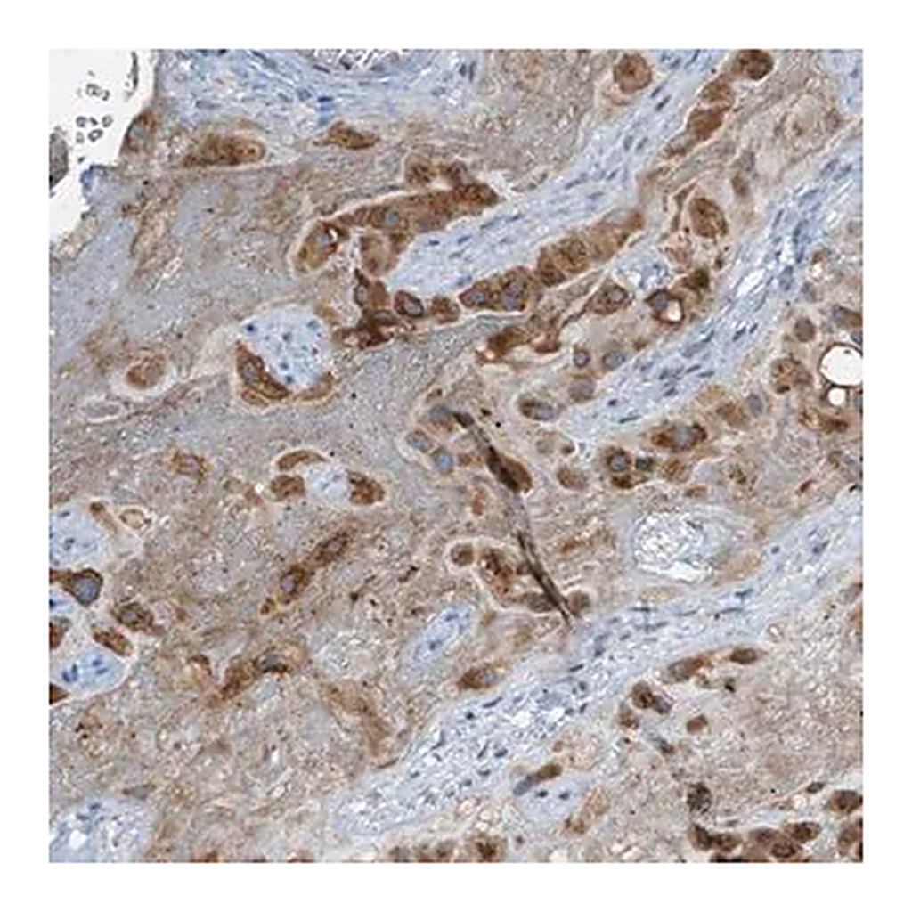 Merck Anti-CHPF2 antibody produced in rabbit