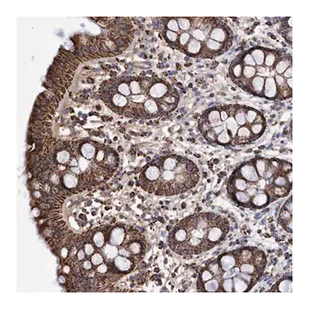 Merck Anti-DSCR3 antibody produced in rabbit