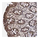 Merck Anti-DSCR3 antibody produced in rabbit