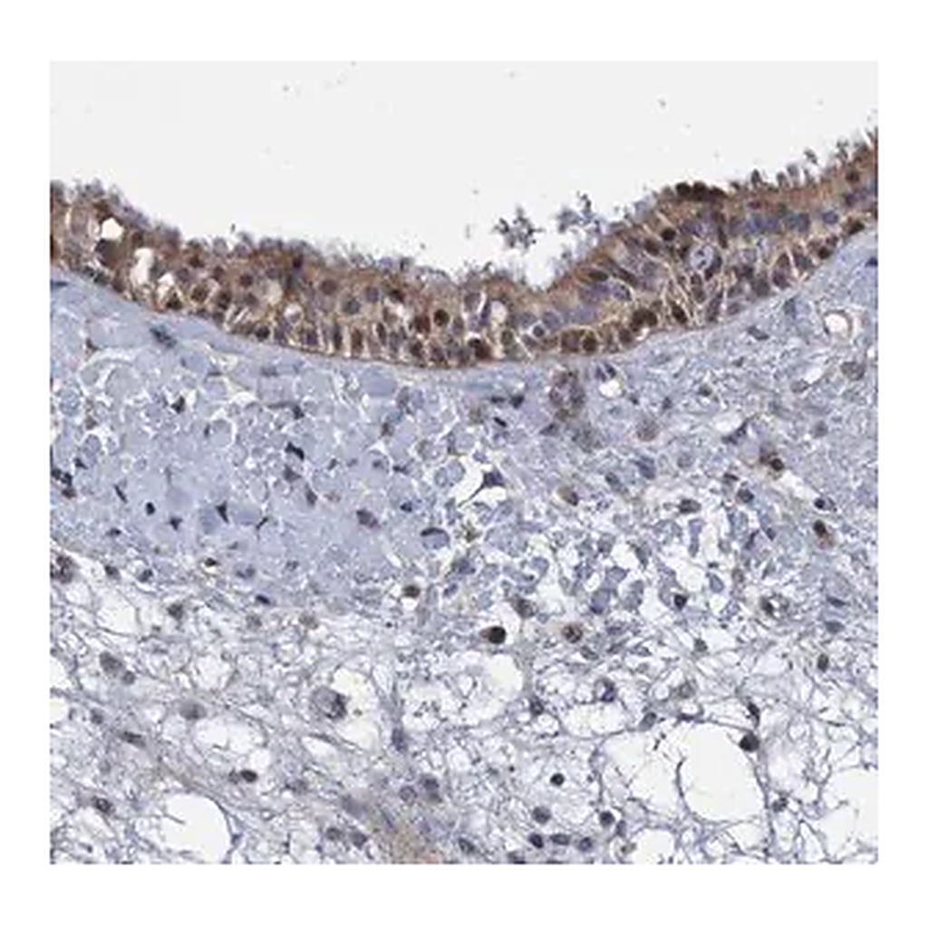 Merck Anti-ZNF677 antibody produced in rabbit