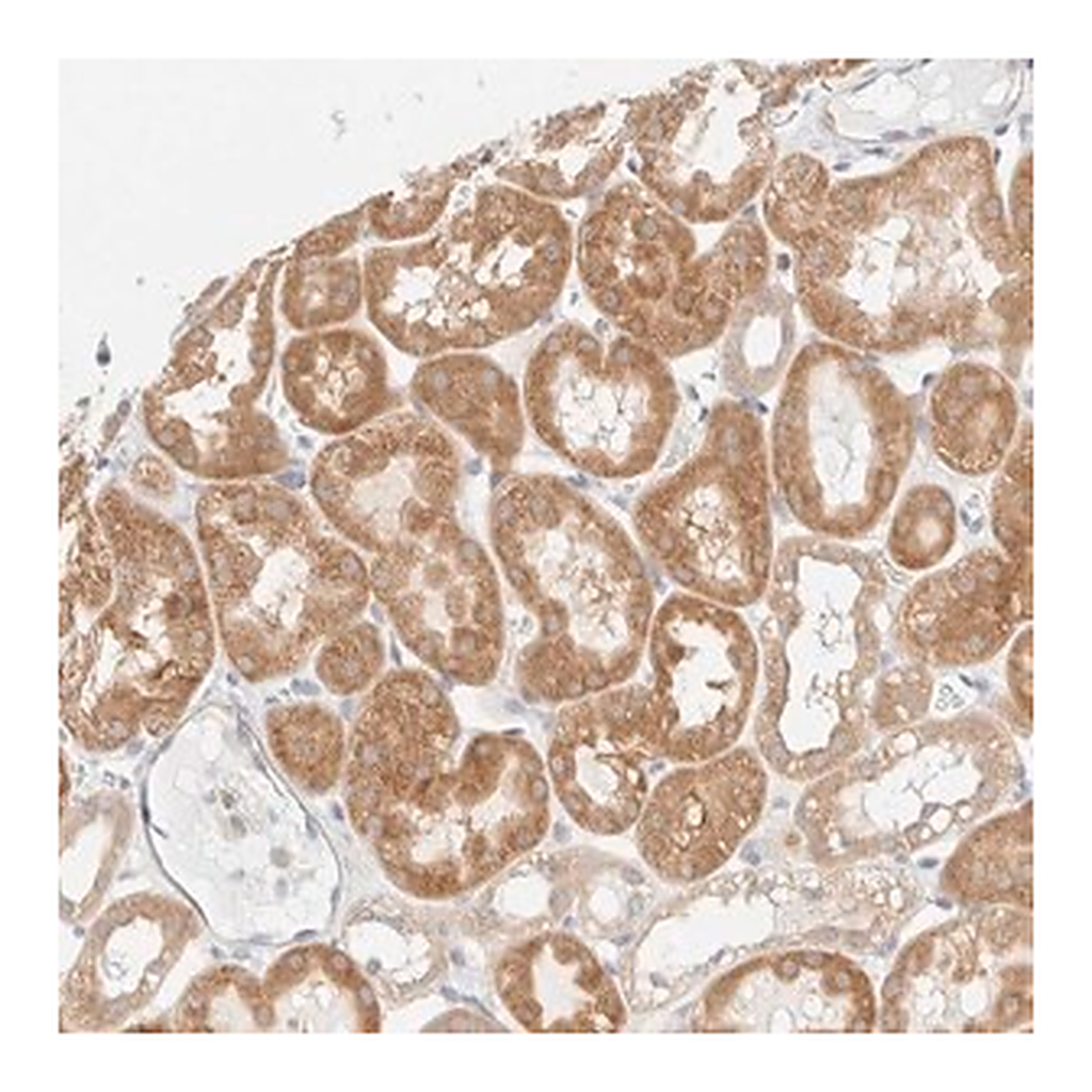 Merck Anti-UNC13B antibody produced in rabbit