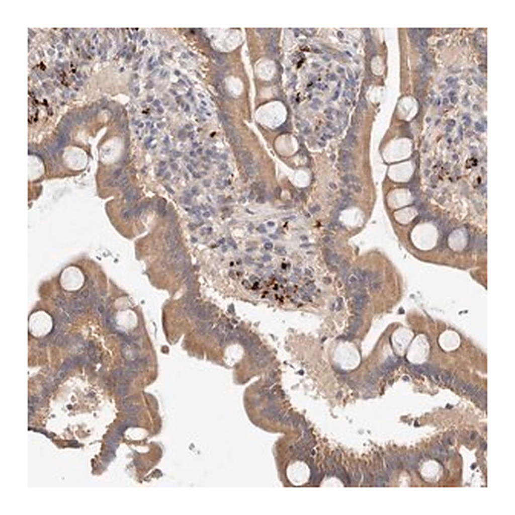 Merck Anti-B3GNTL1 antibody produced in rabbit