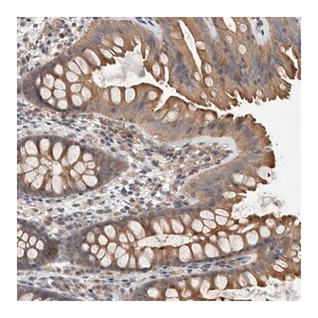 Merck Anti-DCTN6 antibody produced in rabbit