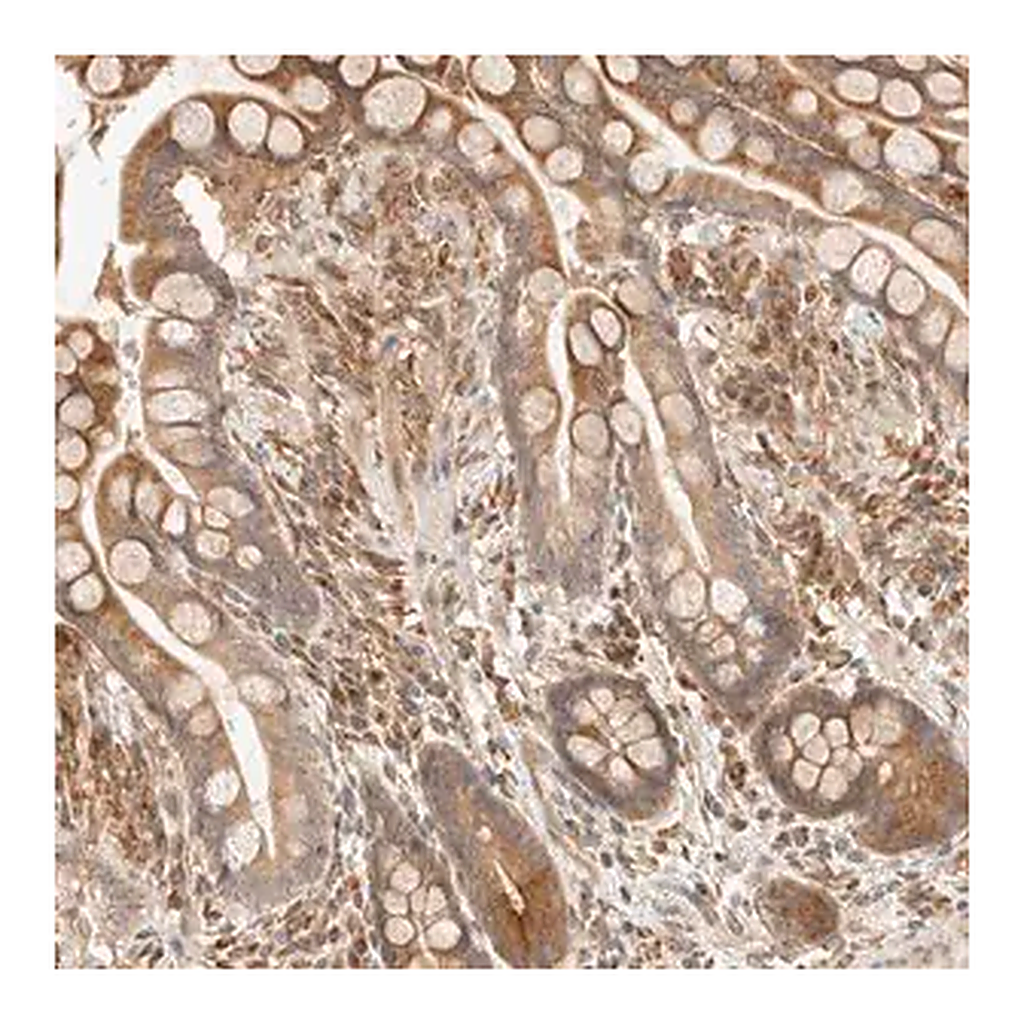 Merck Anti-TACC1 antibody produced in rabbit