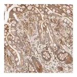 Merck Anti-TACC1 antibody produced in rabbit