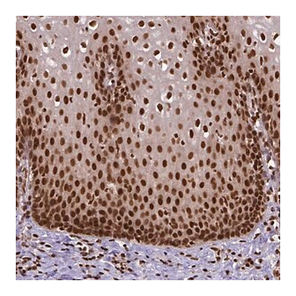 Merck Anti-NACC1 antibody produced in rabbit