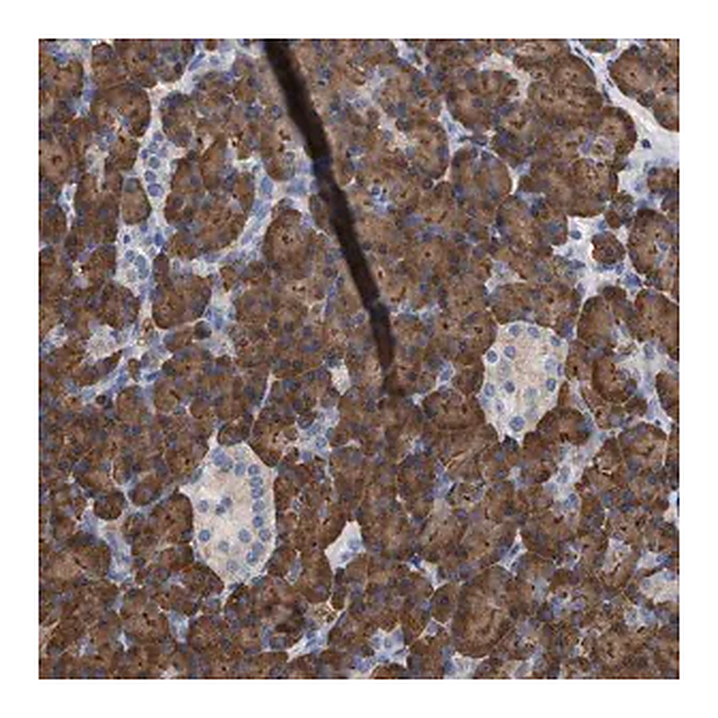 Merck Anti-ERCC6L2 antibody produced in rabbit