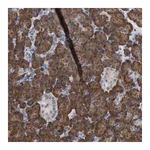 Merck Anti-ERCC6L2 antibody produced in rabbit