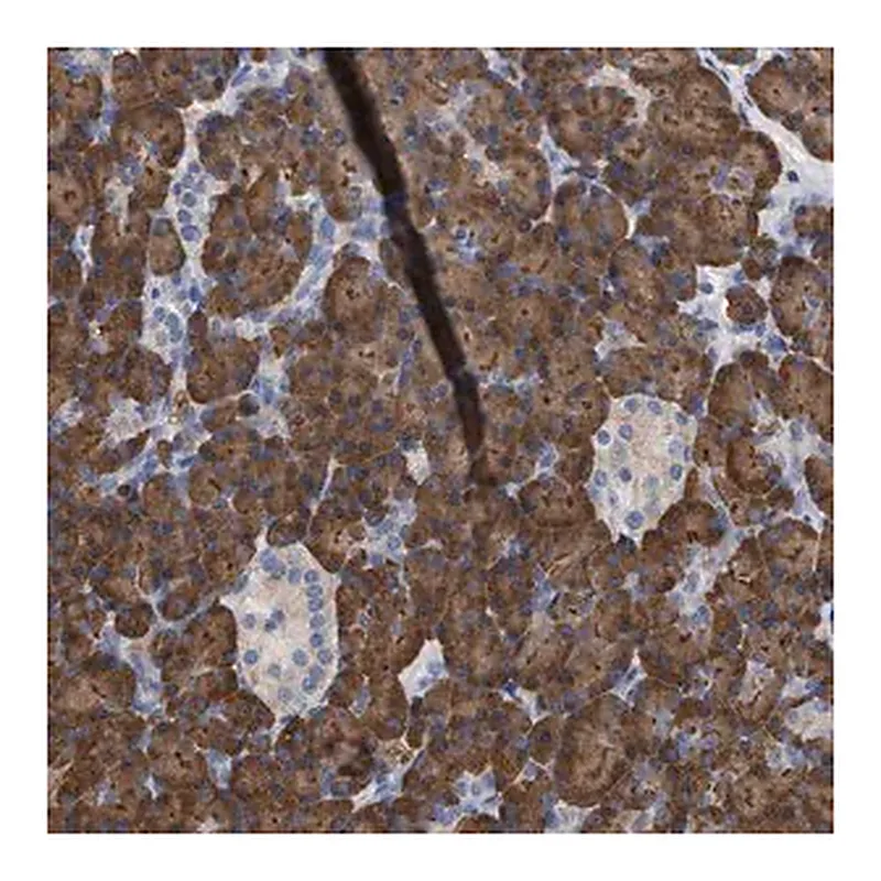 Merck Anti-ERCC6L2 antibody produced in rabbit