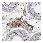 Merck Anti-RNF208 antibody produced in rabbit
