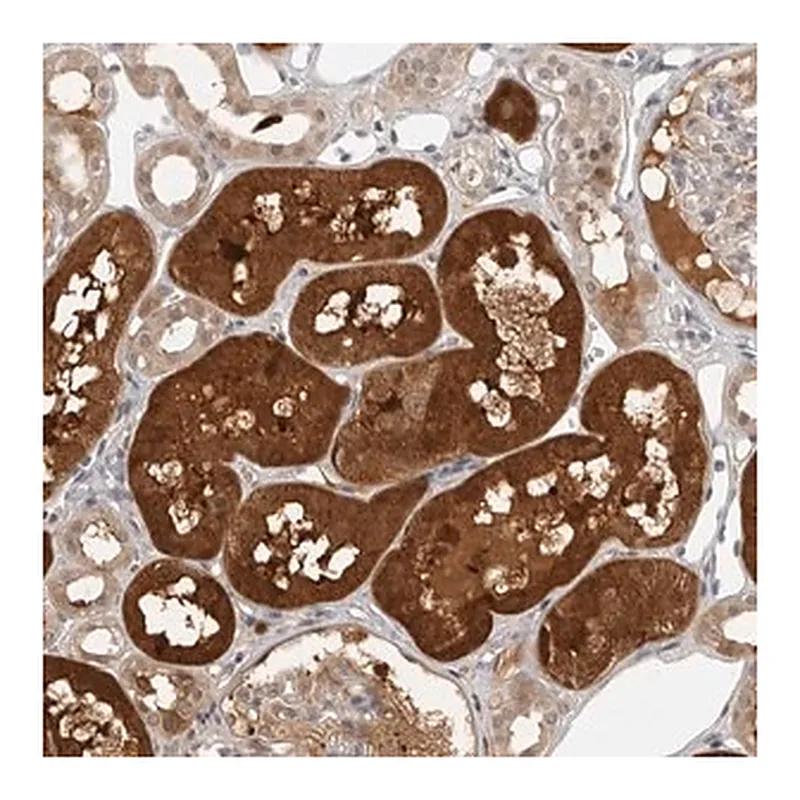Merck Anti-CTIF antibody produced in rabbit