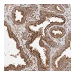 Merck Anti-CRISPLD1 antibody produced in rabbit