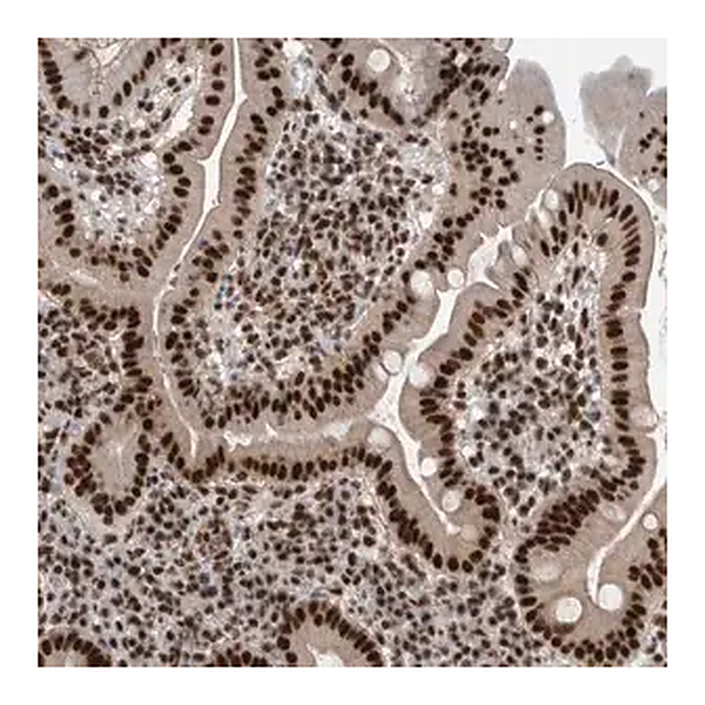 Merck Anti-CDK11A antibody produced in rabbit