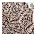 Merck Anti-CDK11A antibody produced in rabbit