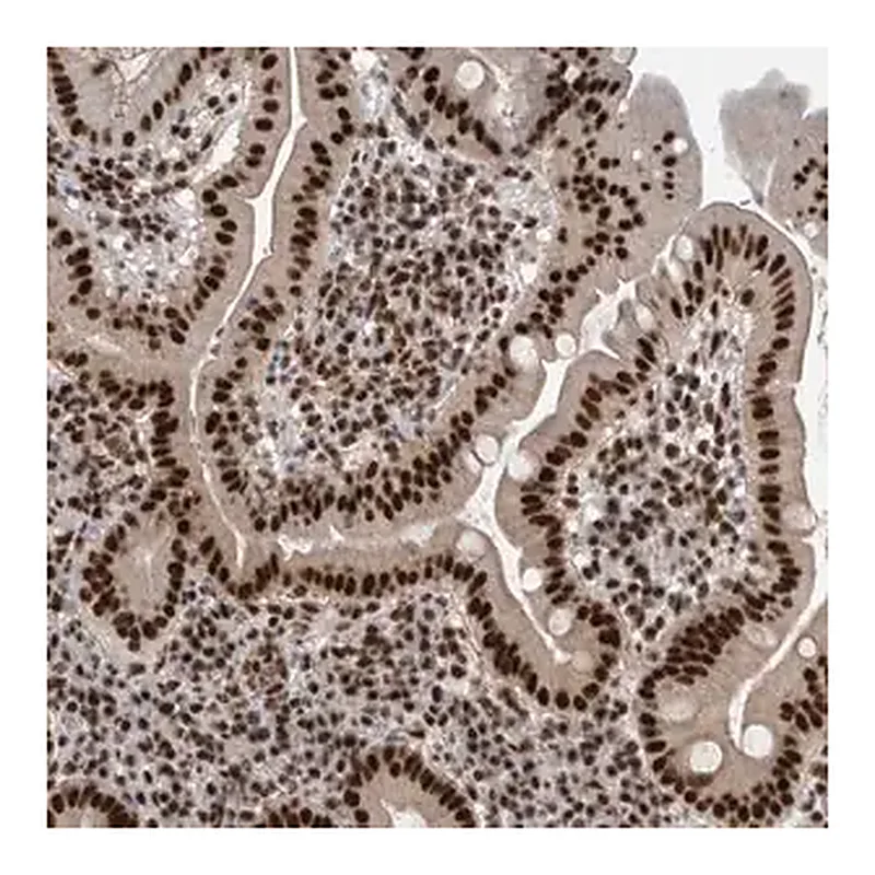 Merck Anti-CDK11A antibody produced in rabbit