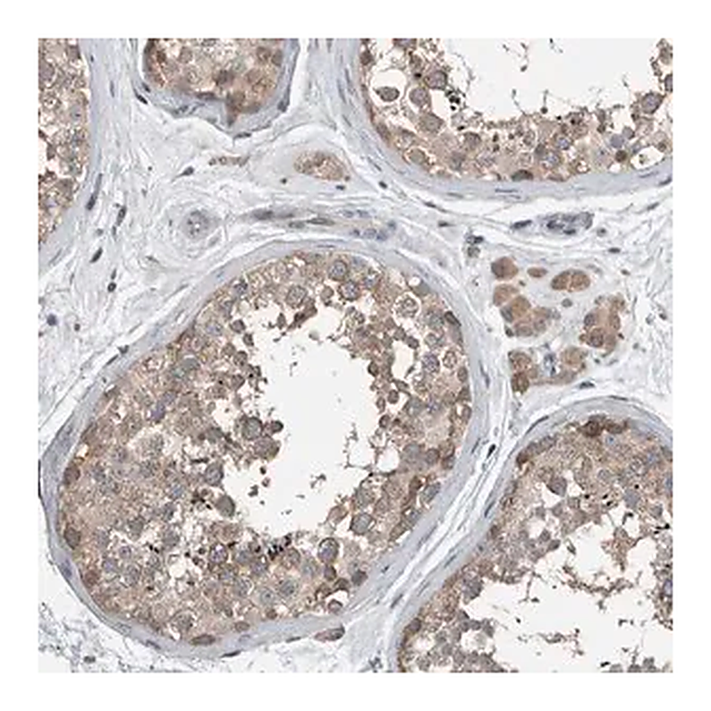Merck Anti-KNTC1 antibody produced in rabbit
