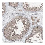Merck Anti-KNTC1 antibody produced in rabbit