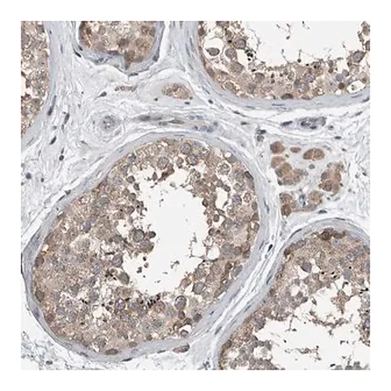 Merck Anti-KNTC1 antibody produced in rabbit