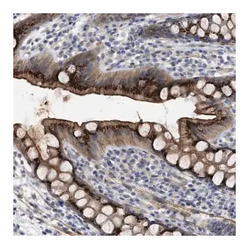 Merck Anti-ST6GALNAC6 antibody produced in rabbit