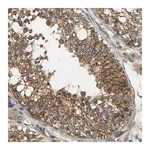 Merck Anti-KIAA1217 antibody produced in rabbit