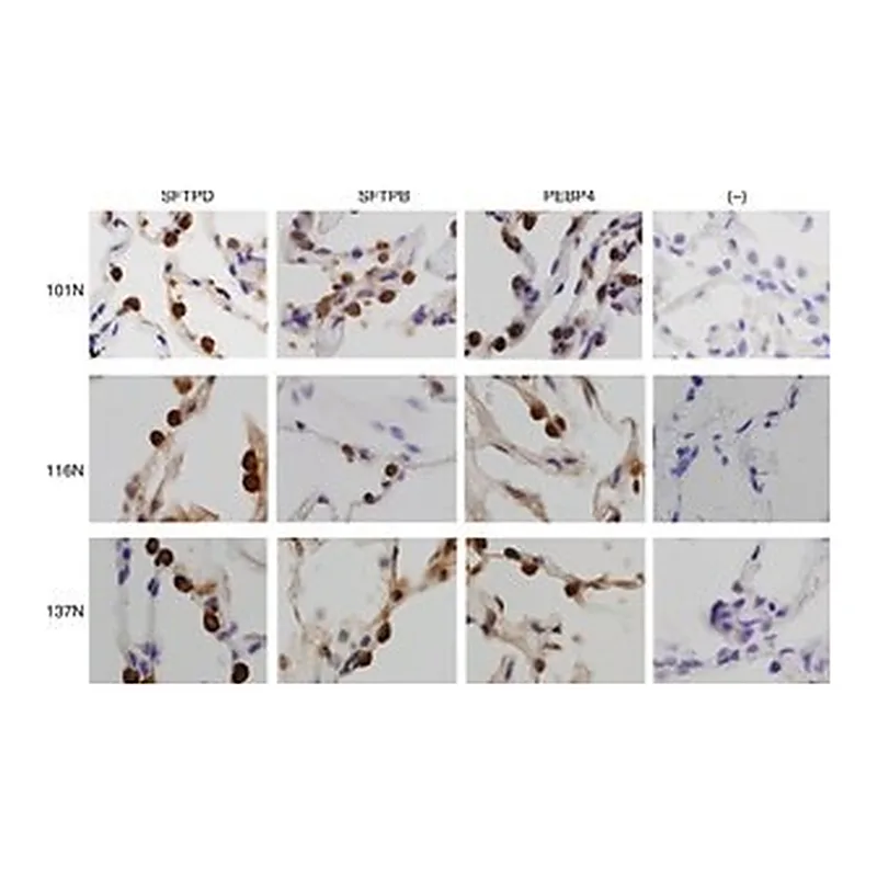 Merck Anti-PEBP4 antibody produced in rabbit