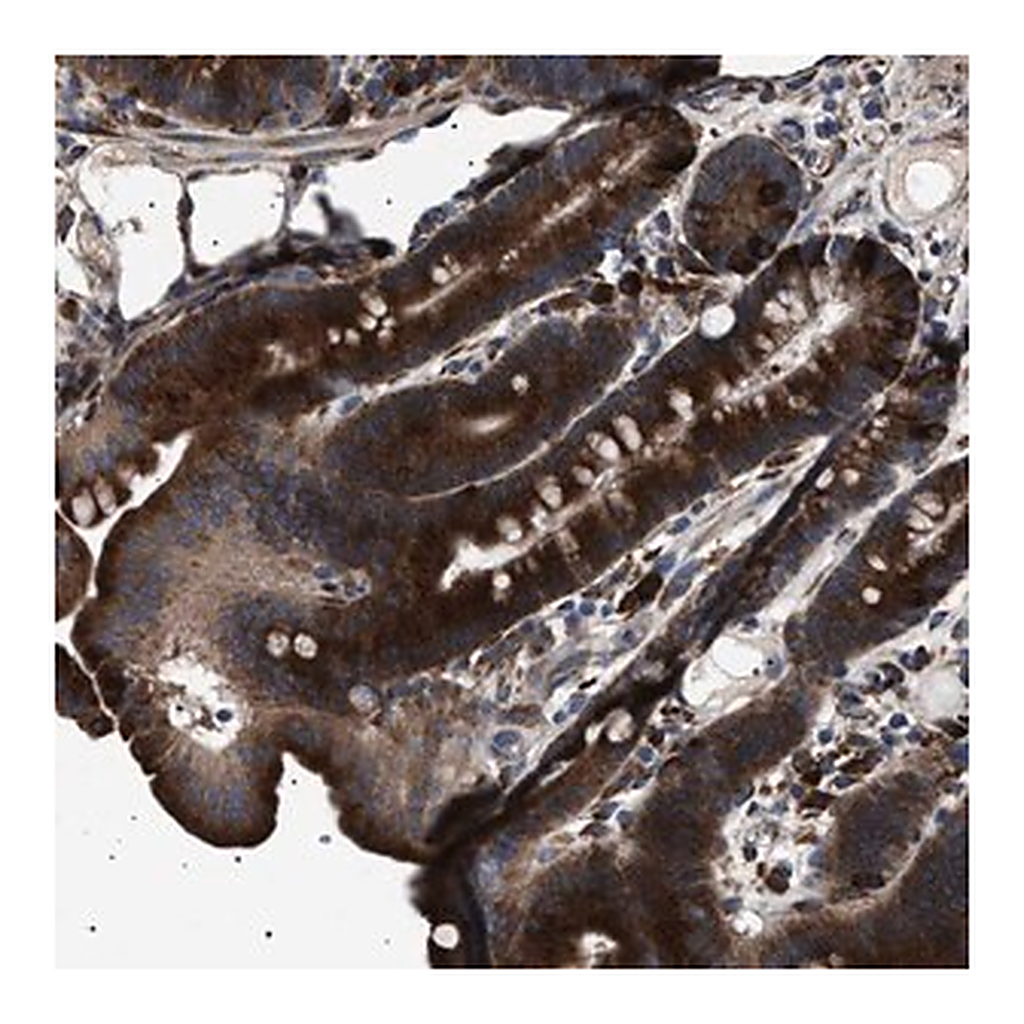 Merck Anti-TOP1MT antibody produced in rabbit