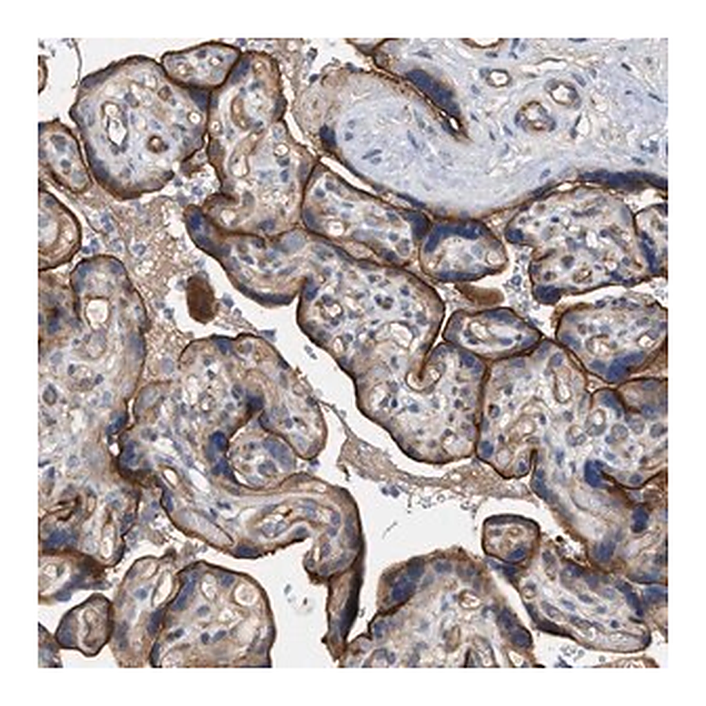 Merck Anti-LRCH1 antibody produced in rabbit