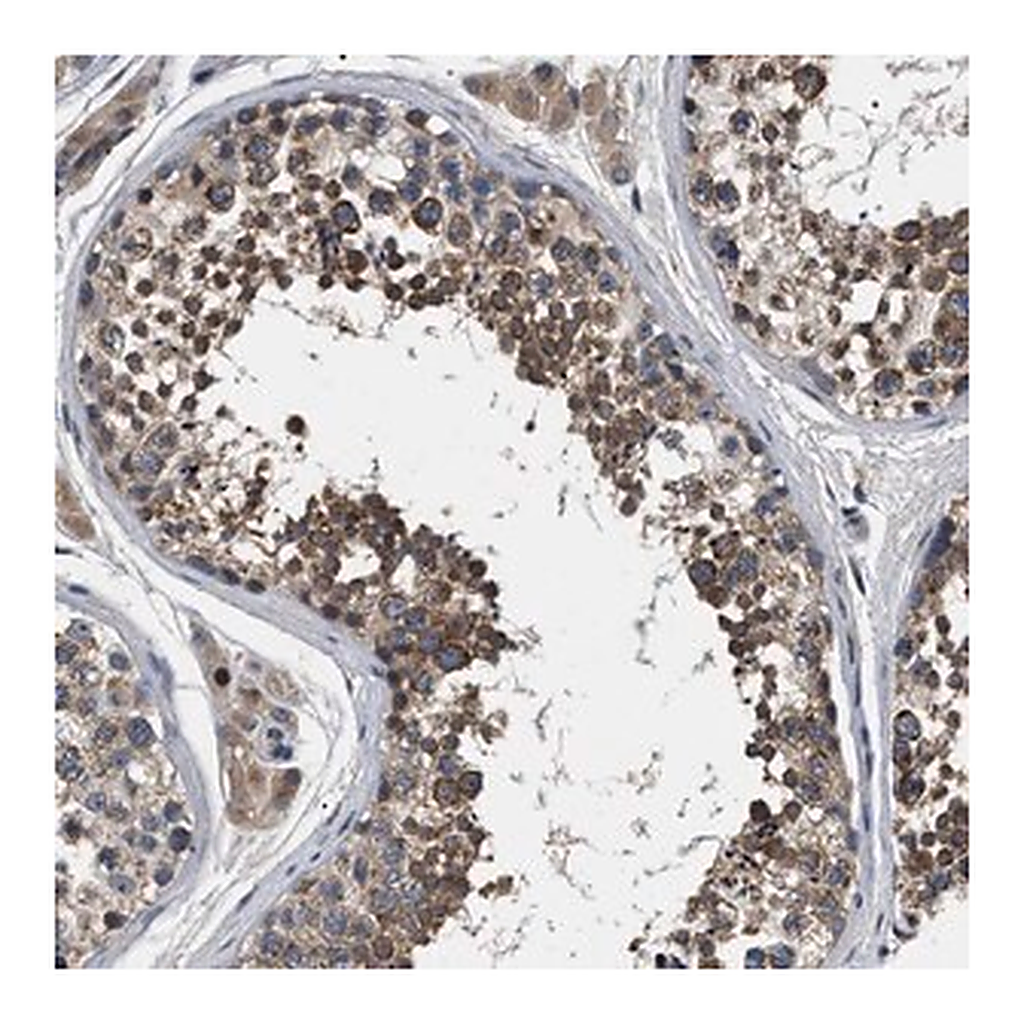 Merck Anti-IFT81 antibody produced in rabbit