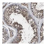 Merck Anti-IFT81 antibody produced in rabbit