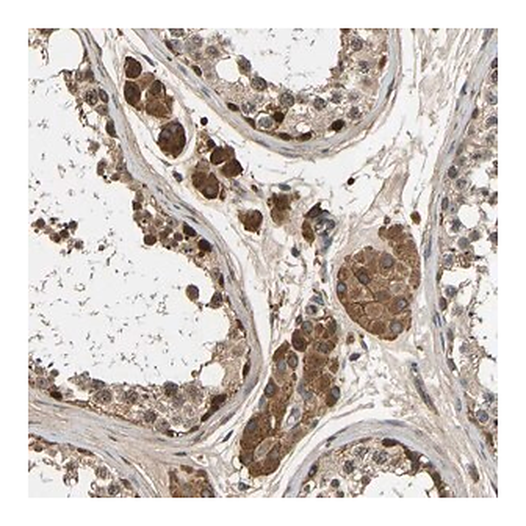 Merck Anti-VCPKMT antibody produced in rabbit