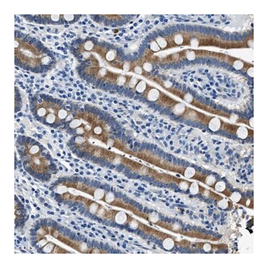 Merck Anti-UBAC2 antibody produced in rabbit