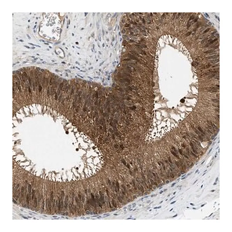 Merck Anti-GMPPB antibody produced in rabbit